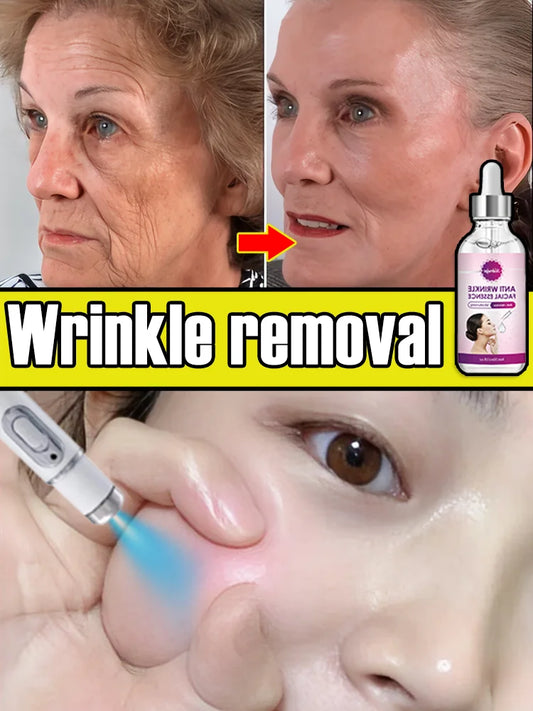 Laser efficient repair